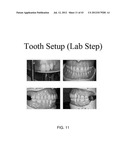 SYSTEMS FOR DENTURE PREPARATION diagram and image