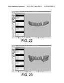 SYSTEMS FOR DENTURE PREPARATION diagram and image