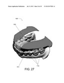 SYSTEMS FOR DENTURE PREPARATION diagram and image