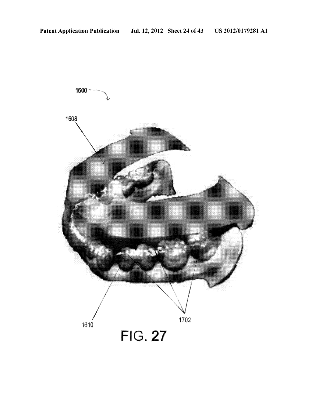 SYSTEMS FOR DENTURE PREPARATION - diagram, schematic, and image 25