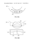 SYSTEMS FOR DENTURE PREPARATION diagram and image