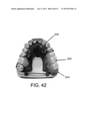 SYSTEMS FOR DENTURE PREPARATION diagram and image