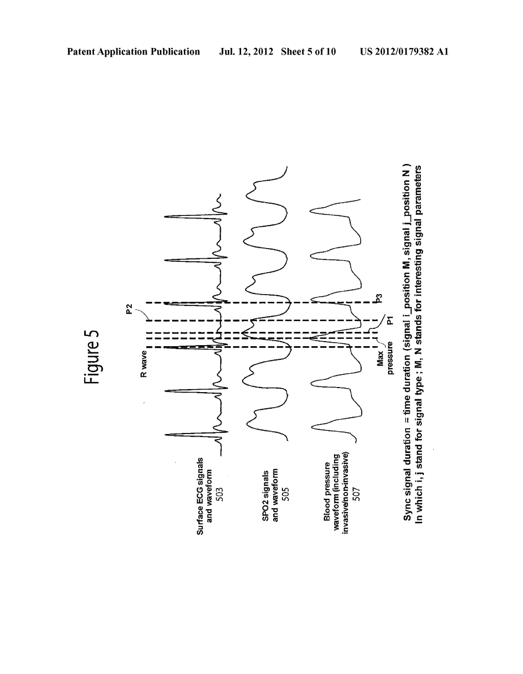 System for Ventricular Arrhythmia Detection and Characterization - diagram, schematic, and image 06