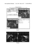 E-medstick, e-medstick, e-medstick EMR diagram and image