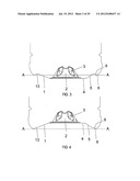 METHOD OF PROCESSING A CONTAINER AND BASE CUP STRUCTURE FOR REMOVAL OF     VACUUM PRESSURE diagram and image