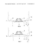 METHOD OF PROCESSING A CONTAINER AND BASE CUP STRUCTURE FOR REMOVAL OF     VACUUM PRESSURE diagram and image