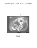 HEAT EXCHANGE SYTEM AND METHOD OF PRODUCING THE SAME diagram and image