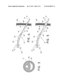 PERCUTANEOUS DILATIONAL DEVICE HAVING BALLOON RETENTION MECHANISM diagram and image