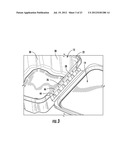 TAMPER-EVIDENT CONTAINER WITH MULTI-ACTION BREAKAWAY HINGE diagram and image