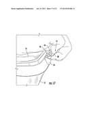 TAMPER-EVIDENT CONTAINER WITH MULTI-ACTION BREAKAWAY HINGE diagram and image