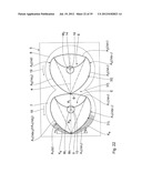 TREATMENT ELEMENT FOR TREATING MATERIAL IN A MULTI-SHAFT WORM MACHINE AND     MULTI-SHAFT WORM MACHINE diagram and image