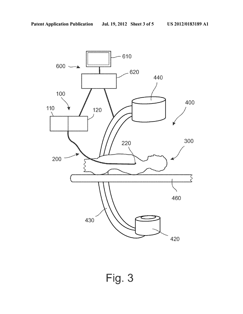 VASCULAR ROADMAPPING - diagram, schematic, and image 04