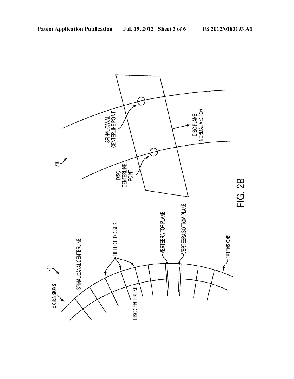 Method and System for Automatic Detection of Spinal Bone Lesions in 3D     Medical Image Data - diagram, schematic, and image 04