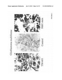 DIAGNOSIS AND TREATMENT OF NEUROECTODERMAL TUMORS diagram and image