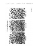 DIAGNOSIS AND TREATMENT OF NEUROECTODERMAL TUMORS diagram and image