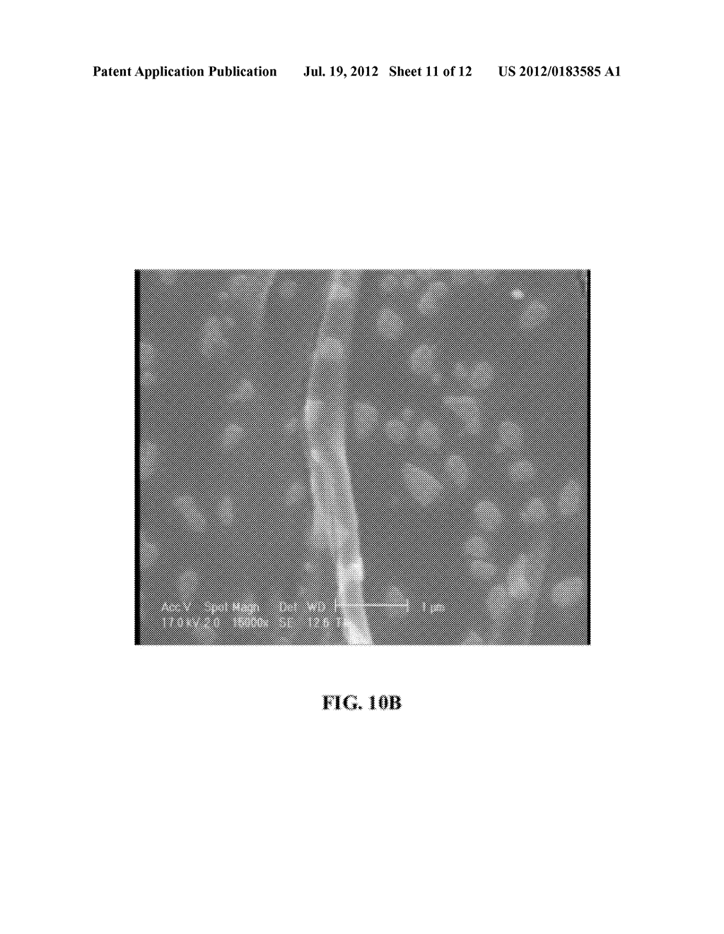 GEL BASED WOUND DRESSING AND A METHOD OF SYNTHESIZING THE SAME - diagram, schematic, and image 12