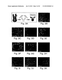 INHIBITORS OF HEDGEHOG SIGNALING PATHWAYS, COMPOSITIONS AND USES RELATED     THERETO diagram and image