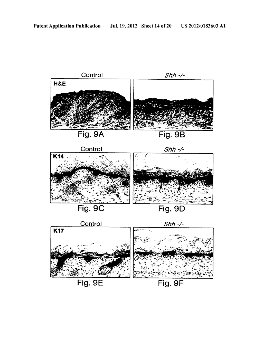 INHIBITORS OF HEDGEHOG SIGNALING PATHWAYS, COMPOSITIONS AND USES RELATED     THERETO - diagram, schematic, and image 15