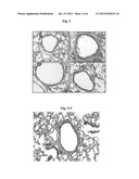 PHARMACEUTICAL COMPOSITION COMPRISING AN EXTRACT OF PSEUDOLYSIMACHION     LONGIFOLIUM AND THE CATALPOL DERIVATIVES ISOLATED THEREFROM HAVING     ANTIINFLAMMATORY, ANTIALLERGIC AND ANTIASTHMATIC ACTIVITY diagram and image