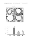 PHARMACEUTICAL COMPOSITION COMPRISING AN EXTRACT OF PSEUDOLYSIMACHION     LONGIFOLIUM AND THE CATALPOL DERIVATIVES ISOLATED THEREFROM HAVING     ANTIINFLAMMATORY, ANTIALLERGIC AND ANTIASTHMATIC ACTIVITY diagram and image