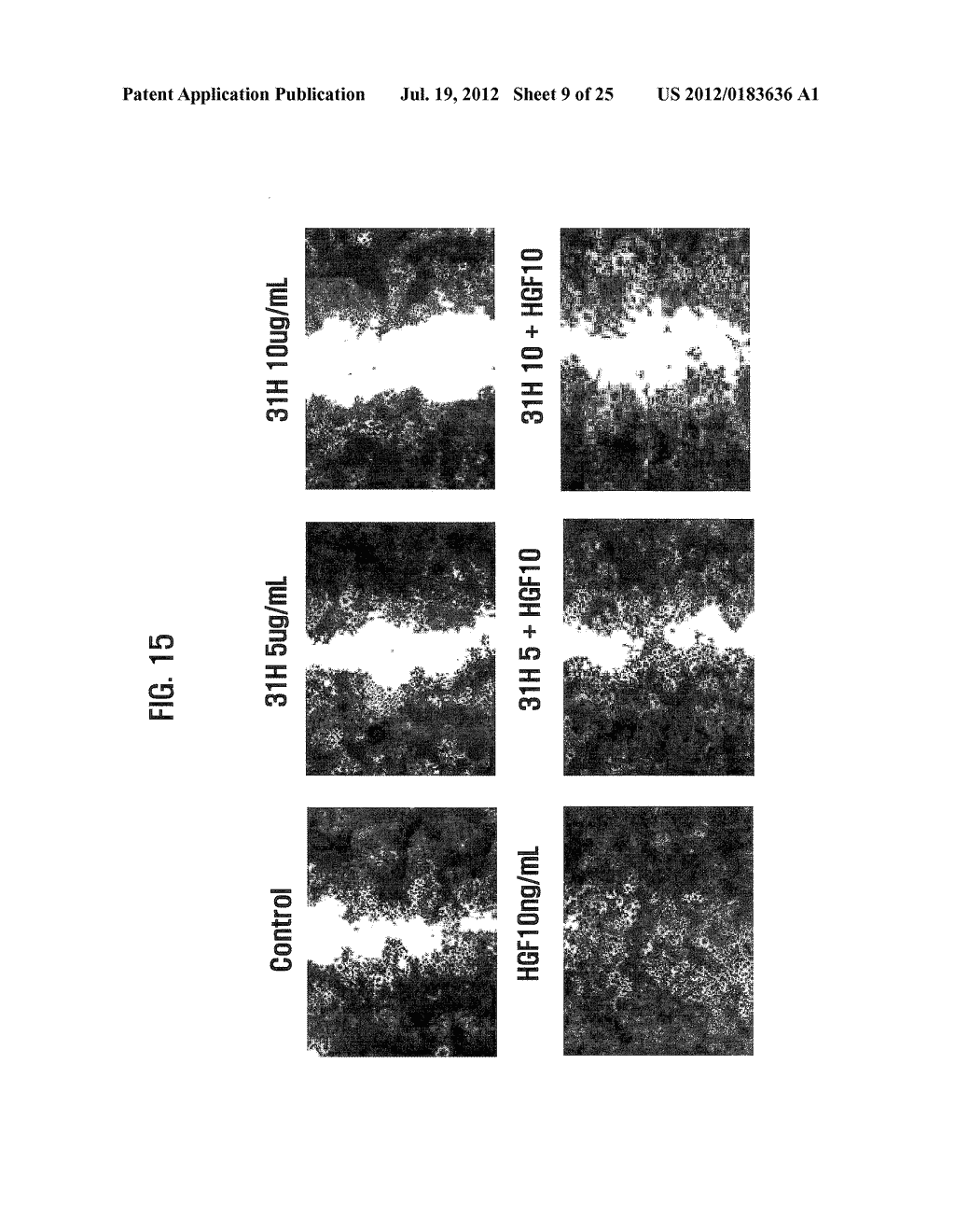 ANTI-CANCER COMPOSITION COMPRISING AQUATIC MICROBIAL EXTRACT - diagram, schematic, and image 10