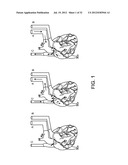 DECELLULARIZATION AND RECELLULARIZATION OF ORGANS AND TISSUES diagram and image