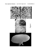 DECELLULARIZATION AND RECELLULARIZATION OF ORGANS AND TISSUES diagram and image