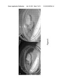 DECELLULARIZATION AND RECELLULARIZATION OF ORGANS AND TISSUES diagram and image