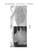 DECELLULARIZATION AND RECELLULARIZATION OF ORGANS AND TISSUES diagram and image