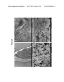 DECELLULARIZATION AND RECELLULARIZATION OF ORGANS AND TISSUES diagram and image