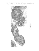 DECELLULARIZATION AND RECELLULARIZATION OF ORGANS AND TISSUES diagram and image