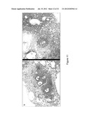 DECELLULARIZATION AND RECELLULARIZATION OF ORGANS AND TISSUES diagram and image