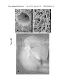 DECELLULARIZATION AND RECELLULARIZATION OF ORGANS AND TISSUES diagram and image