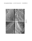 DECELLULARIZATION AND RECELLULARIZATION OF ORGANS AND TISSUES diagram and image