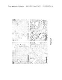 DECELLULARIZATION AND RECELLULARIZATION OF ORGANS AND TISSUES diagram and image