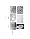 DECELLULARIZATION AND RECELLULARIZATION OF ORGANS AND TISSUES diagram and image