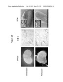 DECELLULARIZATION AND RECELLULARIZATION OF ORGANS AND TISSUES diagram and image