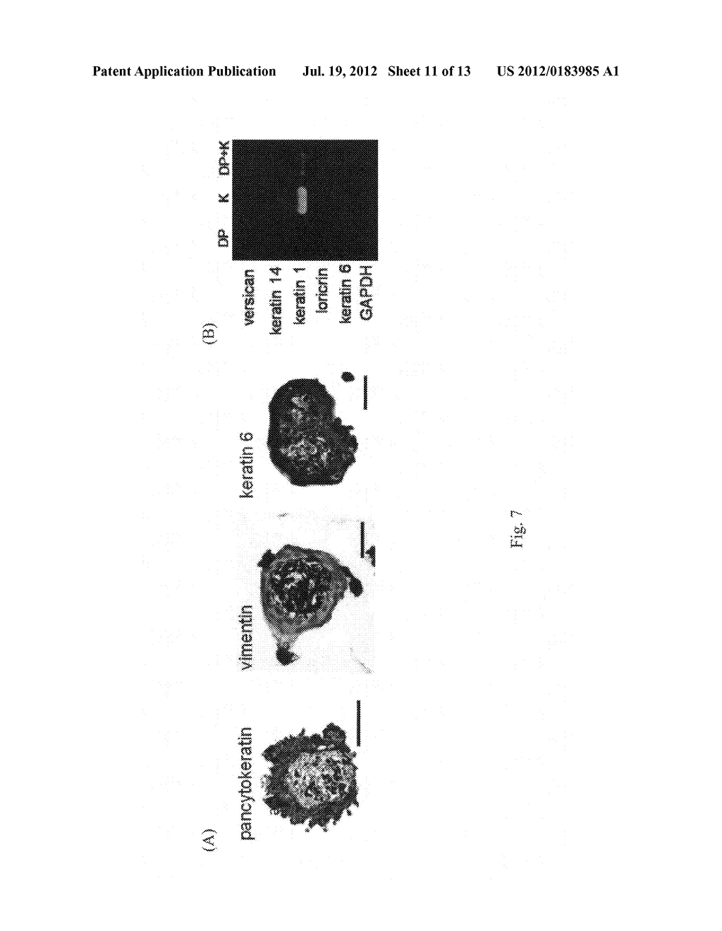 METHOD FOR THE MANUFACTURE OF MICROTISSUES FOR INDUCING THE GROWTH OF A     HAIR FOLLICLE - diagram, schematic, and image 12