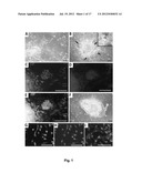 Method of In Vitro Differentiation of Neural Stem Cells, Motor Neurons and     Dopamine Neurons From Primate Embryonic Stem Cells diagram and image