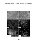 Method of In Vitro Differentiation of Neural Stem Cells, Motor Neurons and     Dopamine Neurons From Primate Embryonic Stem Cells diagram and image