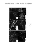 Method of In Vitro Differentiation of Neural Stem Cells, Motor Neurons and     Dopamine Neurons From Primate Embryonic Stem Cells diagram and image