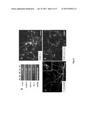 Method of In Vitro Differentiation of Neural Stem Cells, Motor Neurons and     Dopamine Neurons From Primate Embryonic Stem Cells diagram and image