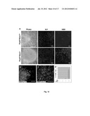 Method of In Vitro Differentiation of Neural Stem Cells, Motor Neurons and     Dopamine Neurons From Primate Embryonic Stem Cells diagram and image