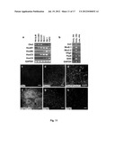 Method of In Vitro Differentiation of Neural Stem Cells, Motor Neurons and     Dopamine Neurons From Primate Embryonic Stem Cells diagram and image