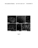 Method of In Vitro Differentiation of Neural Stem Cells, Motor Neurons and     Dopamine Neurons From Primate Embryonic Stem Cells diagram and image