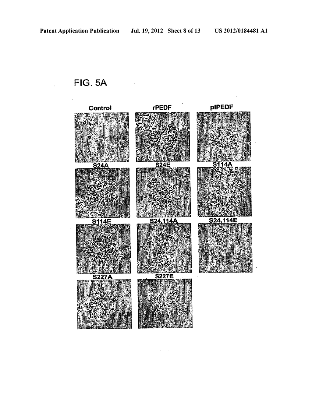 VARIANTS OF PIGMENT EPITHELIUM DERIVED FACTOR AND USES THEREOF - diagram, schematic, and image 09