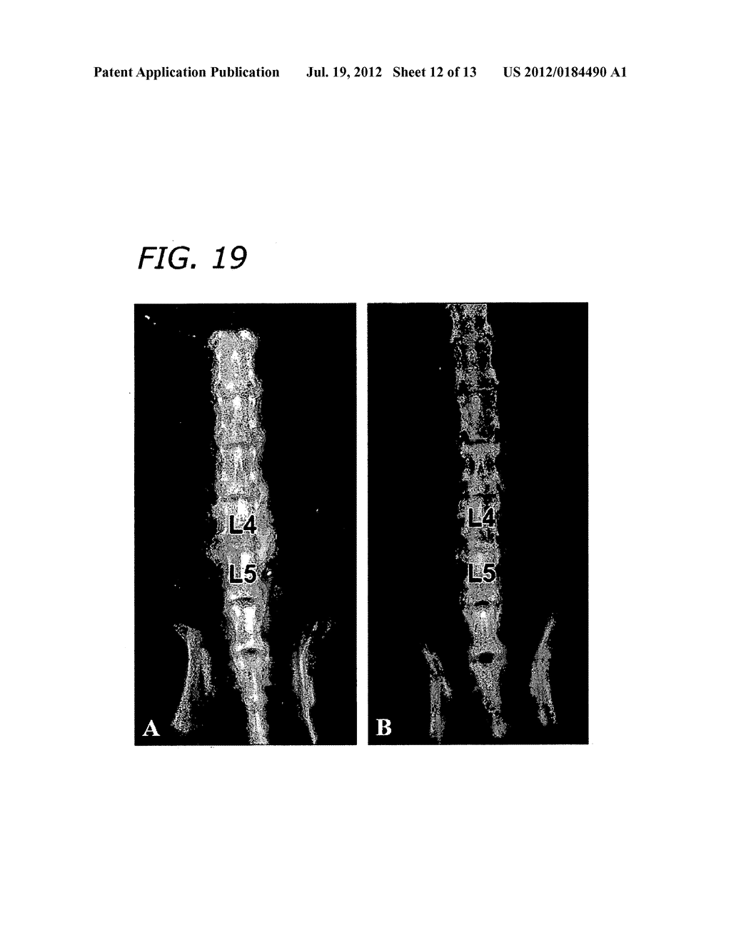 ENHANCEMENT OF BMP RETENTION - diagram, schematic, and image 13