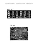 ENHANCEMENT OF BMP RETENTION diagram and image