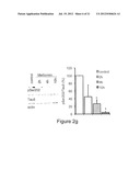 Treatment of Alzheimer s Disease diagram and image