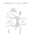 REGULATION OF MATRIX METALLOPROTEINASE (MMP) GENE EXPRESSION IN TUMOR     CELLS VIA THE APPLICATION OF ELECTRIC AND/OR ELECTROMAGNETIC FIELDS diagram and image